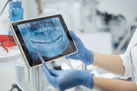 Dentist pointing to X-ray of teeth